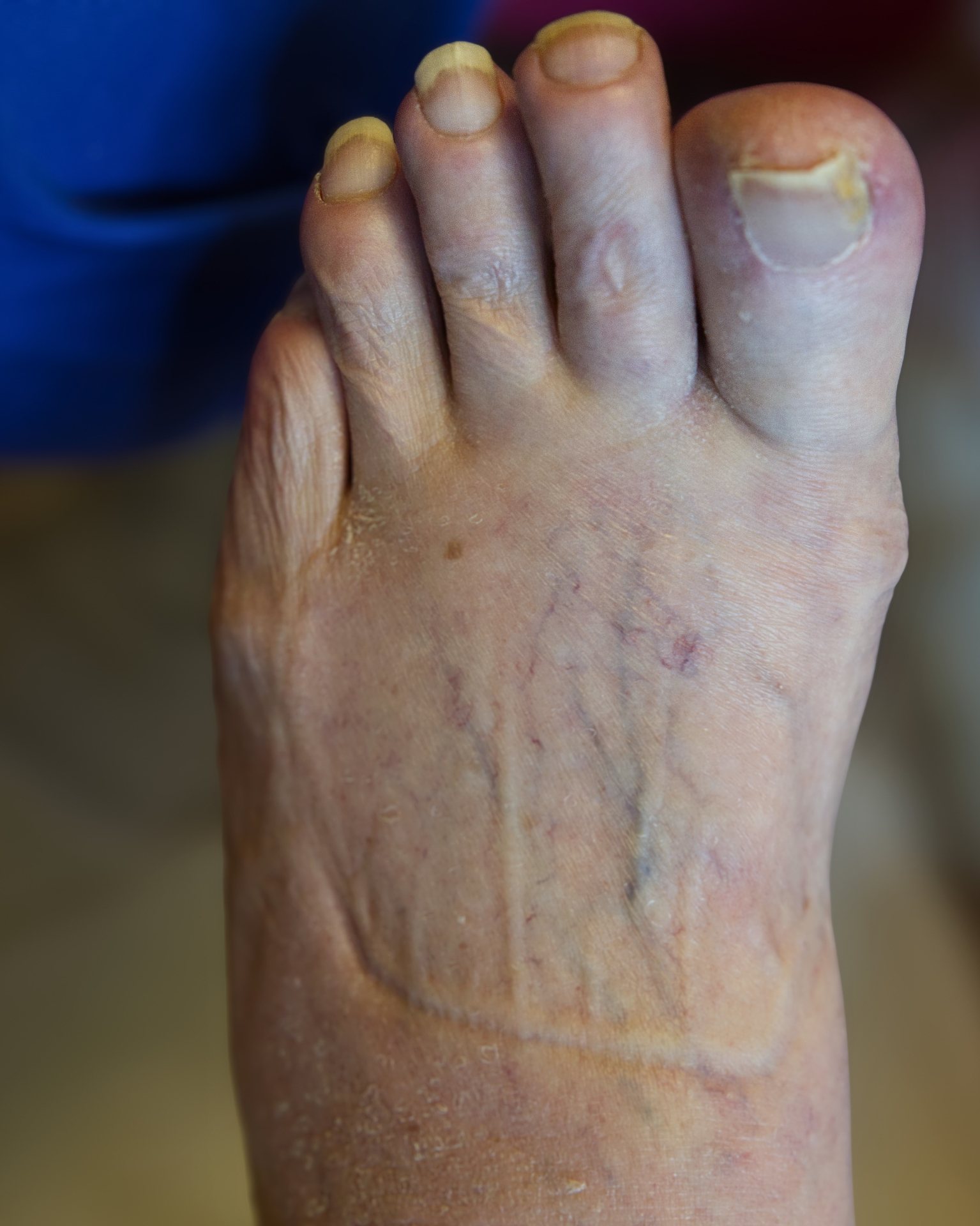 Before treatment