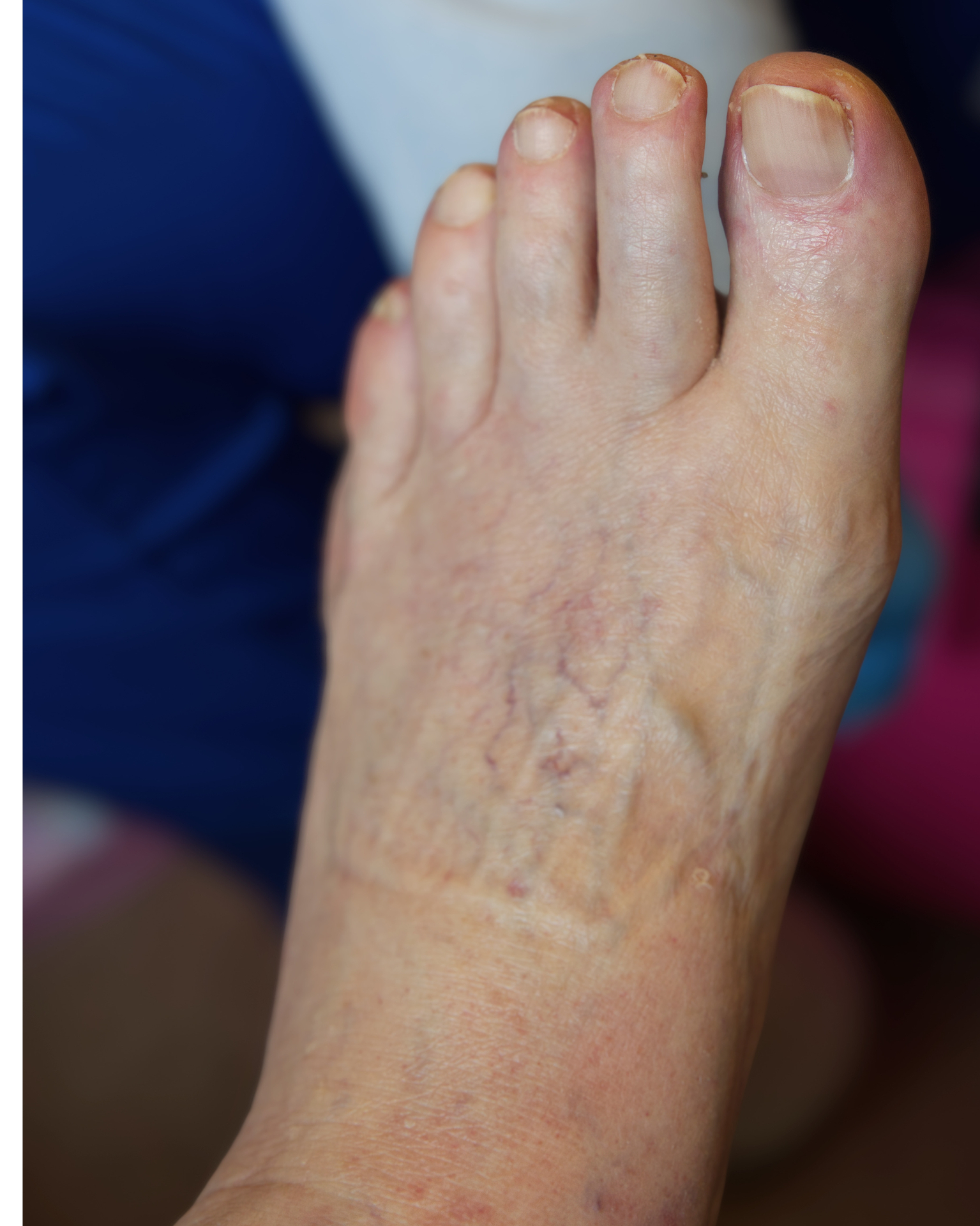After treatment