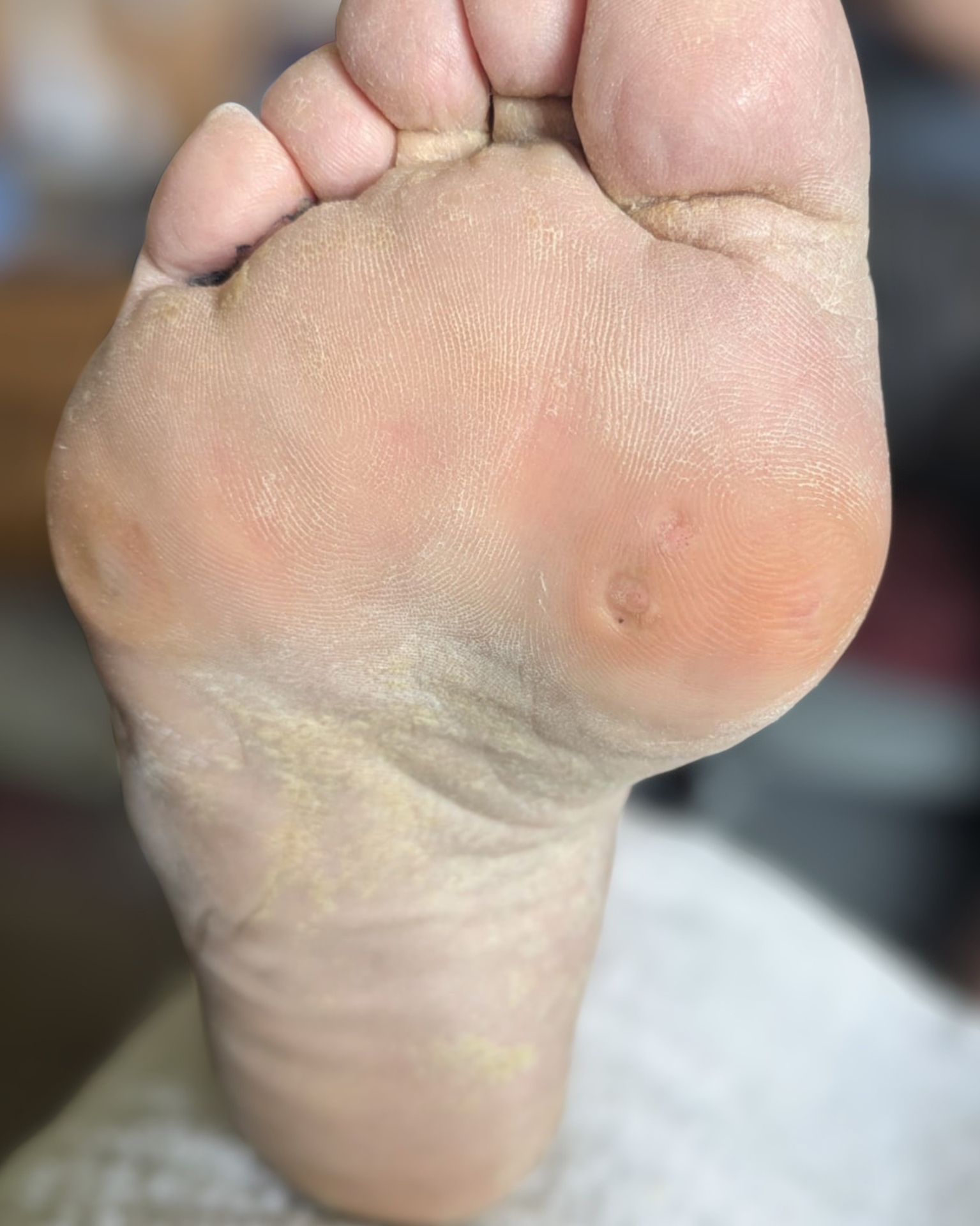 After treatment