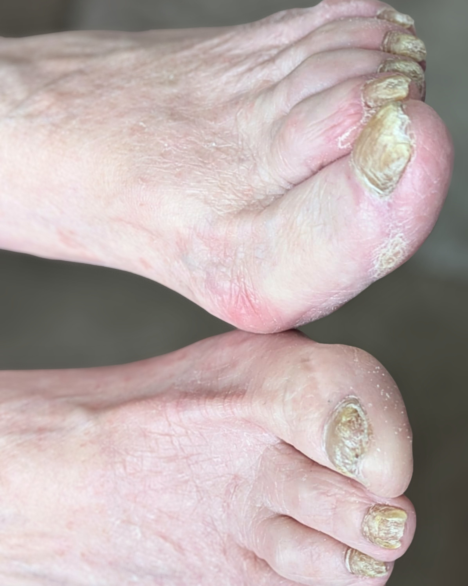 Before treatment