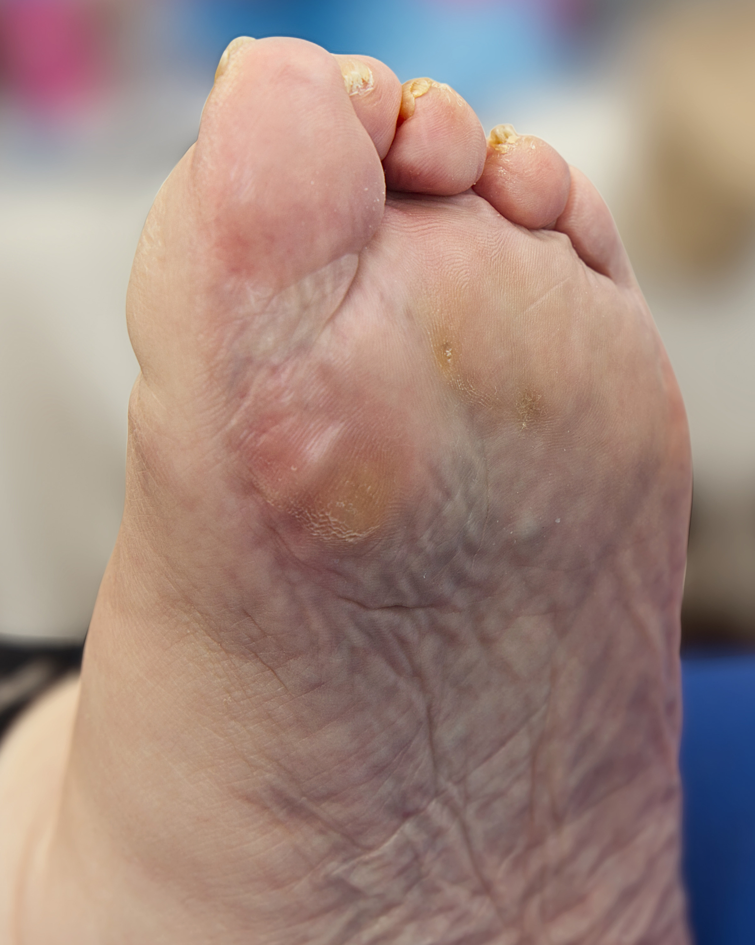 Before treatment