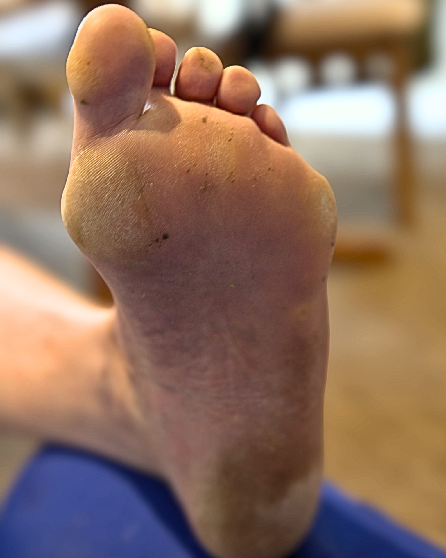 Before treatment