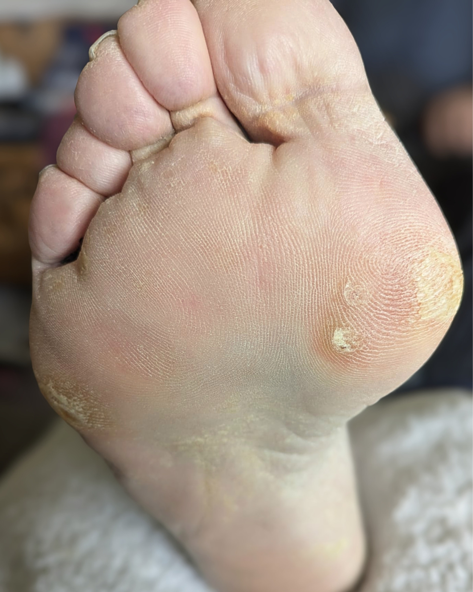 Before treatment