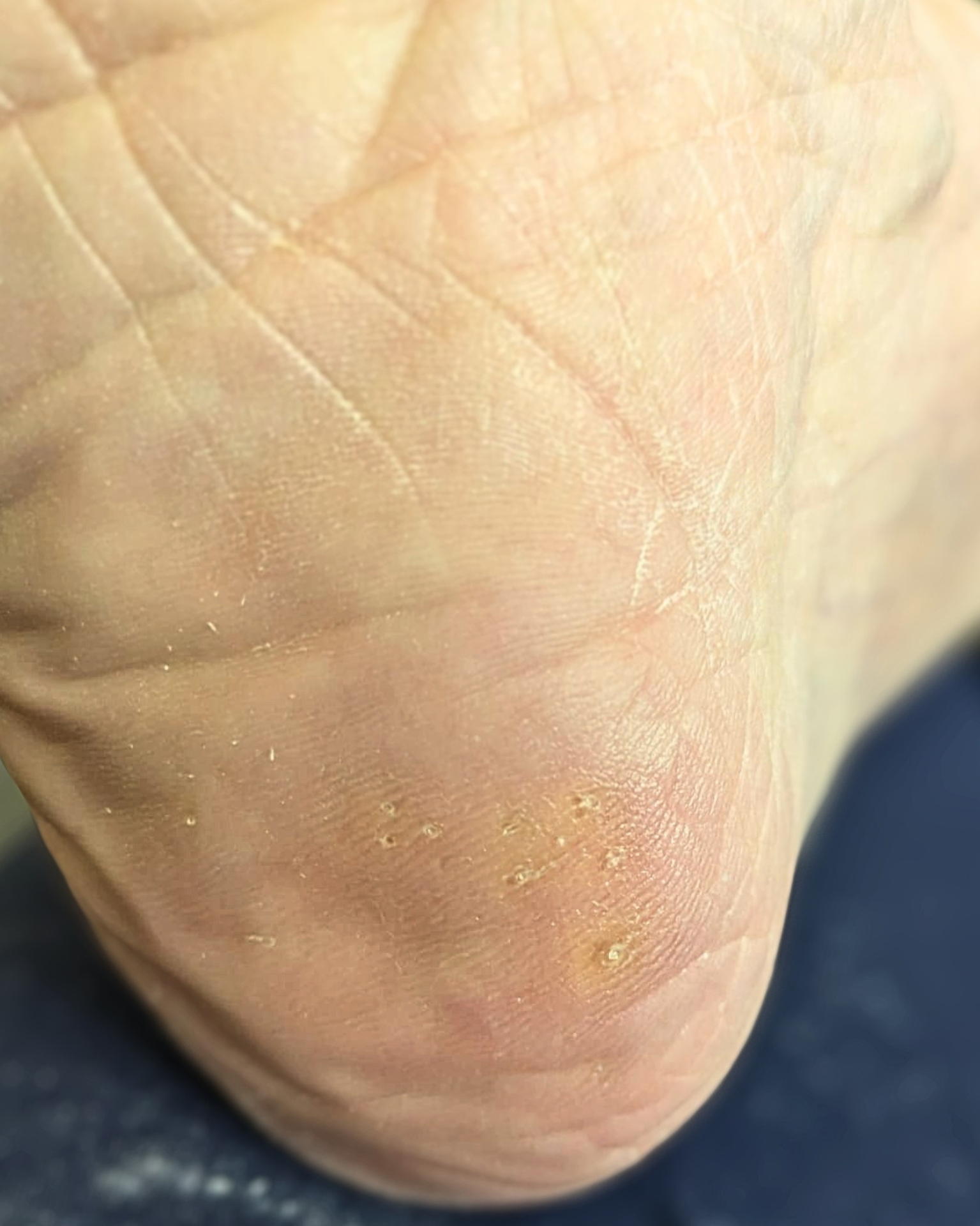 Before treatment
