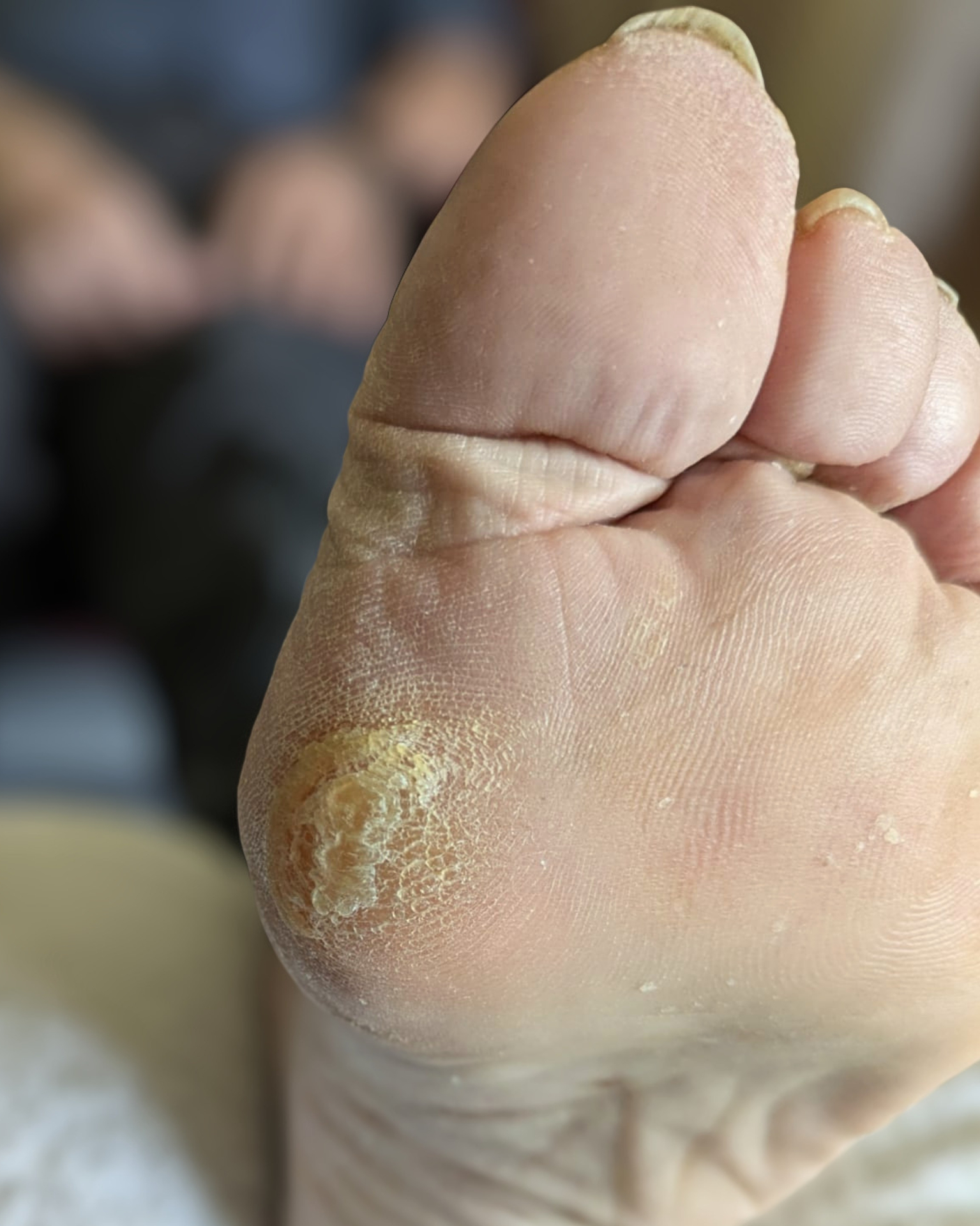 Before treatment