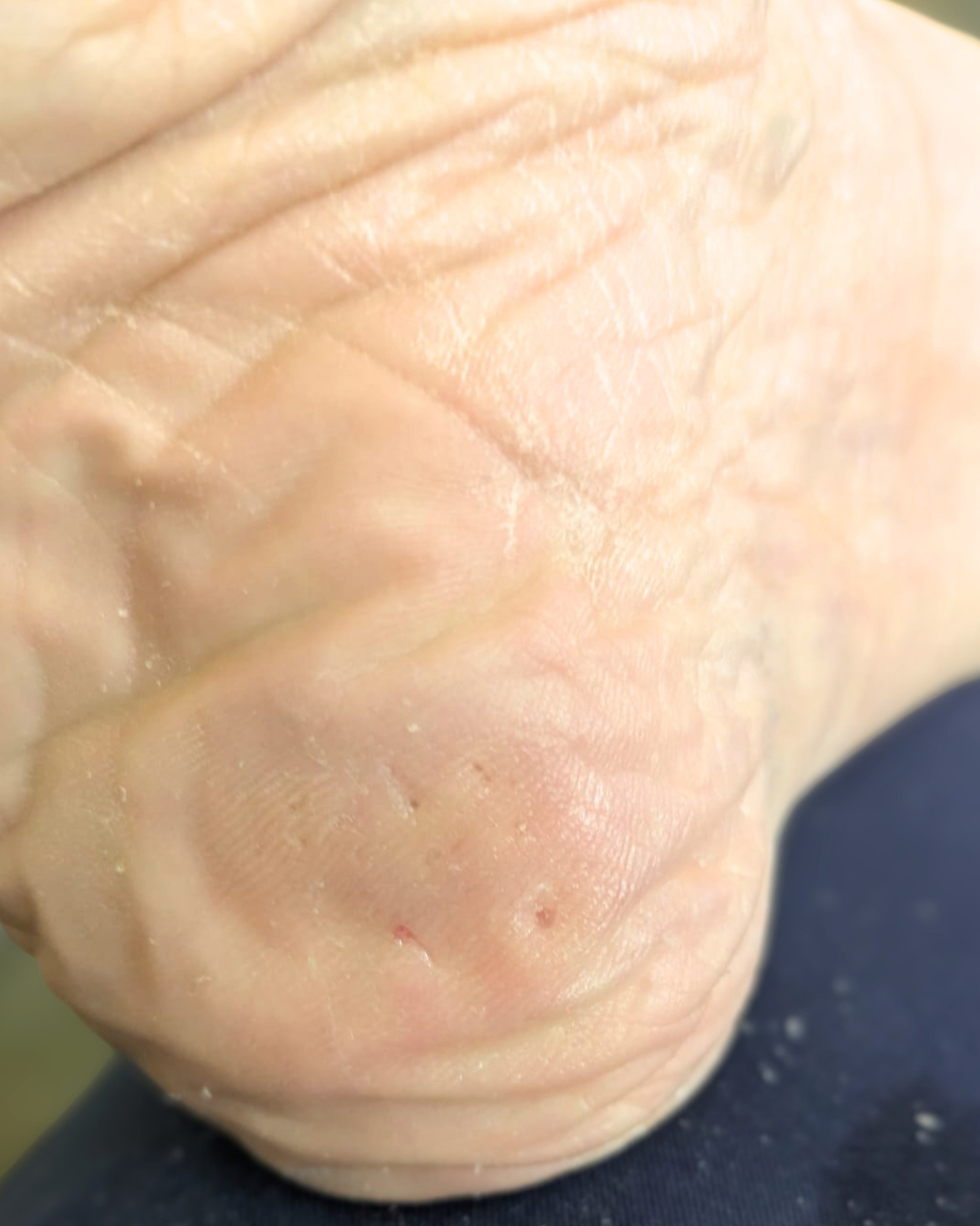 After treatment