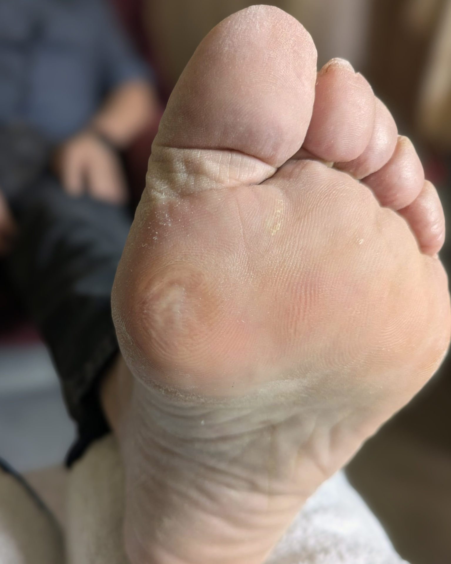 After treatment